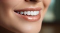 Beautiful wide smile of young fresh woman with great healthy white teeth whitening. Close up Dental image symbolizes oral care