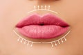 Beautiful woman lips before lip filler injections. Fillers, cosmetology, aesthetic surgery and lip augmentation concept Royalty Free Stock Photo