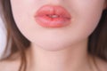 Beautiful woman lips. Lip filling injections, make up, beauty an