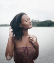 Beautiful young brunette woman with vitiligo disease Royalty Free Stock Photo