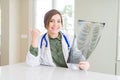 Beautiful young doctor woman looking at chest radiography pointing and showing with thumb up to the side with happy face smiling Royalty Free Stock Photo