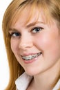 Beautiful young woman with brackets on teeth Royalty Free Stock Photo