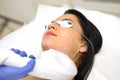 Beautiful young woman lying on a table with protect glasses on eyes getting a laser skin treatment Royalty Free Stock Photo