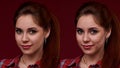 Beautiful young woman with problem skin Young Woman Before And After Royalty Free Stock Photo