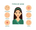 Beautiful Young Woman and Types of Acne. Isolated Teenager Girl with a Bad Problem Skin of Face. Infection, Rash and Redness on