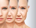 Beauty concept skin aging. anti-aging procedures, rejuvenation, lifting, tightening of facial skin Royalty Free Stock Photo