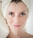 beauty concept - skin care, anti-aging procedures, rejuvenation, lifting, tightening of facial skin Royalty Free Stock Photo