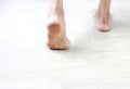 Beauty medical concept - The Dehydrated dry skin on the woman`s heel is cracked which pain while walking must using moisturizin