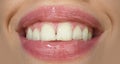 Beauty smile mouth expression concept. Dental care, healthy teeth and smile, white teeth in mouth. Closeup of smile with Royalty Free Stock Photo