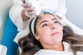 Beauty treatment using microneedling device with radio frequency to tighten skin. Used on the forehead of a woman during treatment Royalty Free Stock Photo