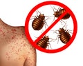 BedBug Bites