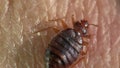 Bedbug sitting on human skin