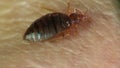 Bedbug sitting on human skin