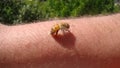 Bee : apis mellifera. treatment by honey bee sting. closeup honey bee stinging a hand. close up bee worker. insects, insect, anima Royalty Free Stock Photo