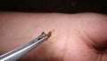 Bee : apis mellifera treatment by honey bee sting closeup honey bee stinging a hand close up bee worker insects, insect, animal, w Royalty Free Stock Photo