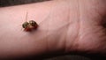 Bee : apis mellifera. treatment by honey bee sting. closeup honey bee stinging a hand. close up bee worker  insects, insect, anima Royalty Free Stock Photo