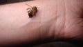 Bee : apis mellifera. treatment by honey bee sting closeup honey bee stinging a hand. close up bee worker . insects, insect, anima Royalty Free Stock Photo