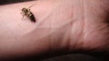 Bee : apis mellifera treatment by honey bee sting closeup honey bee stinging a hand close up bee worker insects, insect, animal, w Royalty Free Stock Photo