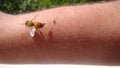 Bee : apis mellifera. treatment by honey bee sting. closeup honey bee stinging a hand. close up bee worker. insects, insect, anima Royalty Free Stock Photo