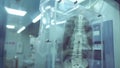 Behind the protective glass partition a radiology technologist expertly operates the fluoroscopy machine capturing live