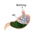 Belching. Air in the stomach. The structure of the esophagus and stomach. Infographics. Vector illustration