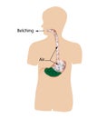 Belching. Air in the stomach. The structure of the esophagus and stomach. Infographics. Vector illustration