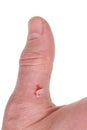 A big dirty finger of a worker with a bloody callus from a shove