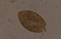 Big size Fasciola parasite egg. Royalty Free Stock Photo