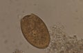 Big size Fasciola parasite egg. Royalty Free Stock Photo