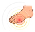Big toe pain Royalty Free Stock Photo