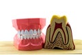 Big tooth model for demonstation on white wooden background.Saved with clipping path