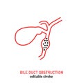 Bile duct obstruction icon in outline style.
