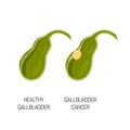 Healthy and cancer gallbladder, vector concept