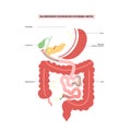 Biliopancreatic diversion procedure