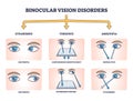 Binocular vision disorders with all eye defect examples outline diagram