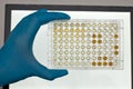 biochemical test - colorful reaction result