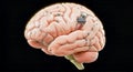 Bionic brain with chip, front view against dark background. Royalty Free Stock Photo