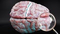 Bipolar ii disorder in human brain