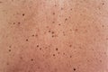 Human skin texture stock photo