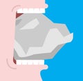 Bite stone. Gnaw granite. Broken teeth. Open mouth and stone. Vector illustration