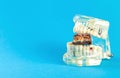 A bitten chocolate bar in a dental jaw mockup on a blue background. The concept of sweets harming tooth enamel, caries