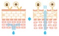 Sectional view of the skin illustration. Comparison of protection effect between healthy skin and wounded skin