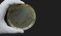 Black bacteria colonies on Selective media Agar Plates in petri dish