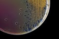 Black bacterial colonies of Salmonella species on Salmonella Shigella agar (SS agar, selective and differential medium) plate on Royalty Free Stock Photo