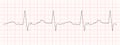Black heart beat diagram printed on red graph paper. ECG chart. Cardiac rhythm line. Cardio test sign. Cardiology