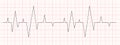 Black heart beat diagram on red graph paper. Electrocardiogram chart. Cardiac rhythm line. Cardio test sign. Cardiology
