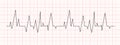 Black heartbeat chart on red graph paper. Electrocardiogram line. Cardiac rhythm or cardio test sign. Cardiology