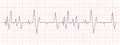 Black heartbeat diagram on red graph paper. Electrocardiogram chart. Cardio test line. Cardiac rhythm symbol. Vector