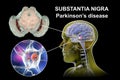 Substantia nigra, a basal banglia of the midbrain, in Parkinson's disease, 3D illustration