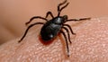 A black tick on a person\'s skin